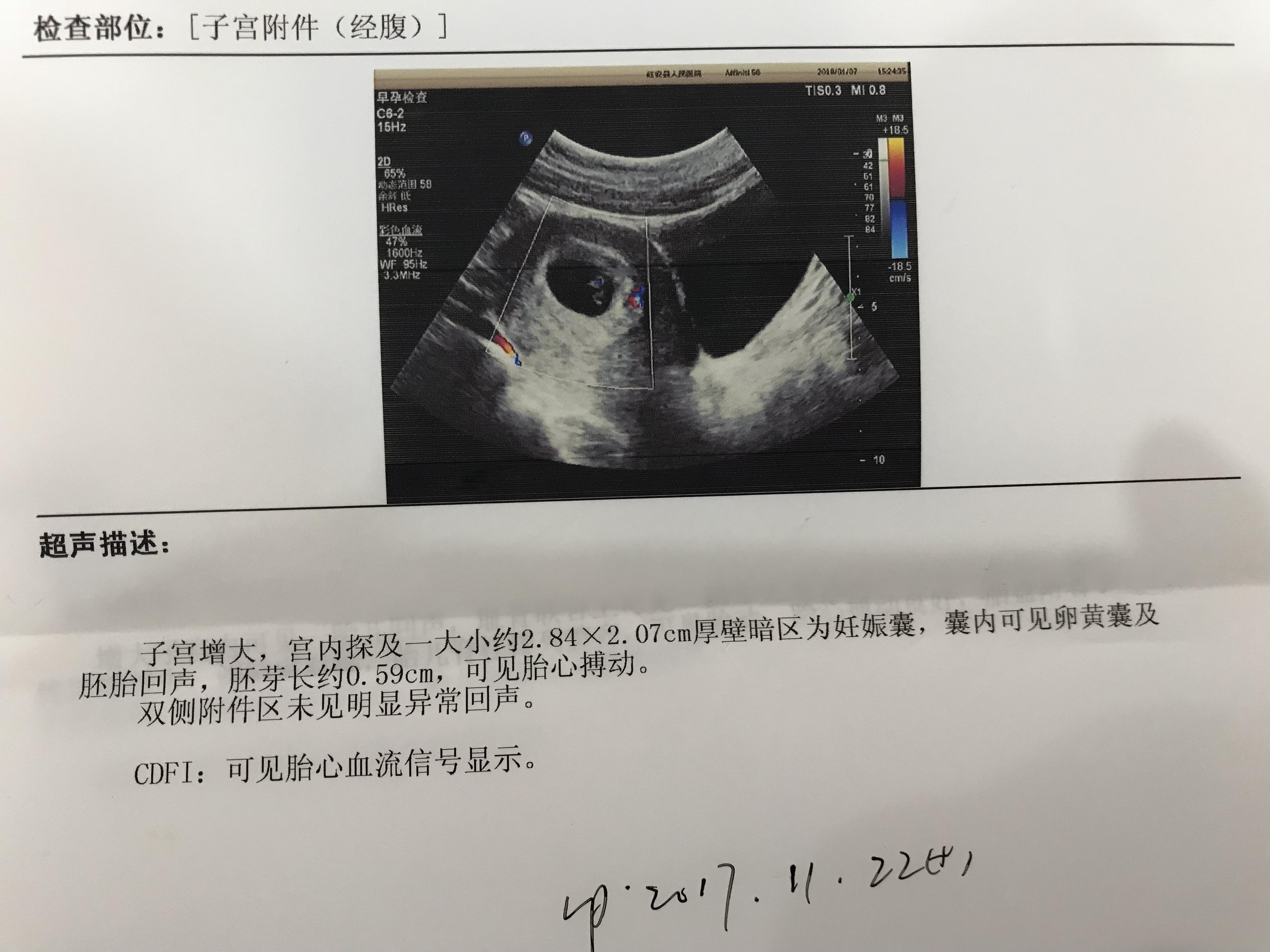 45个月男宝宝发育指标关于45个月男宝宝发育指标详解